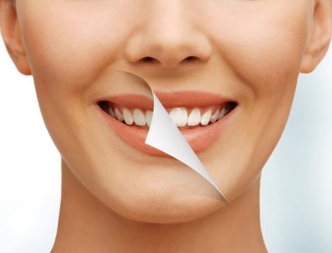 Sakız Çiğnemenin Diş Sağlığına Faydaları