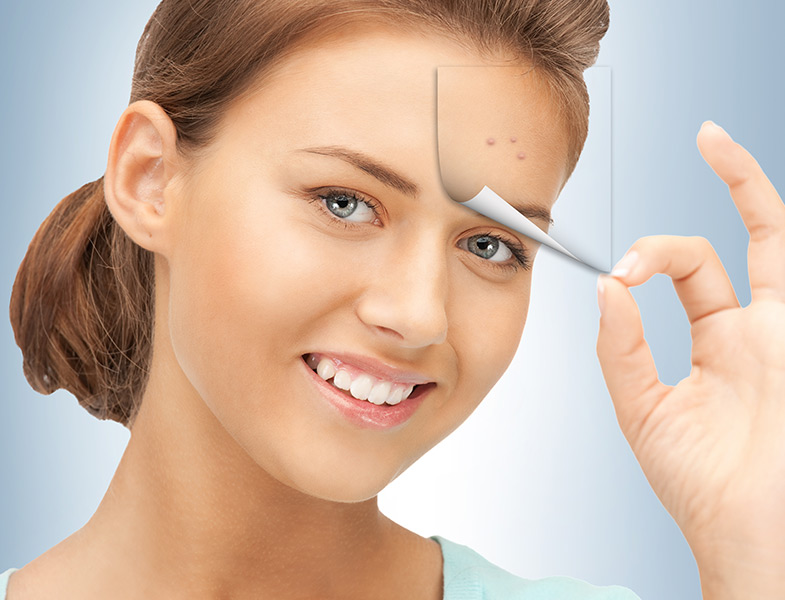 Güneş Lekeleri İçin Eylül Ayı Tedaviye Başlama Zamanı