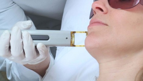 Lazer Epilasyonun Sağlığa Zararı Var mı