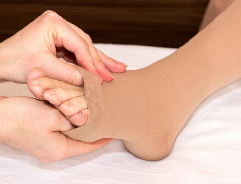 Her 5 Kadından Birinde Görülen Kronik Venöz Yetmezlik Nedir