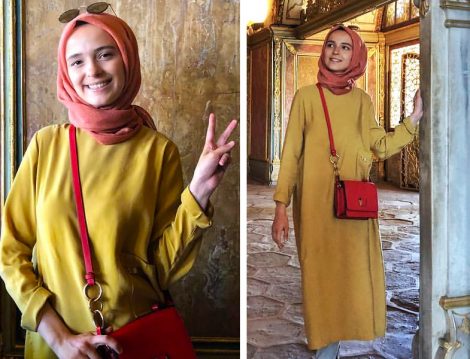 Esra Keskin Demir Hardal Sarı Tunik Modeli
