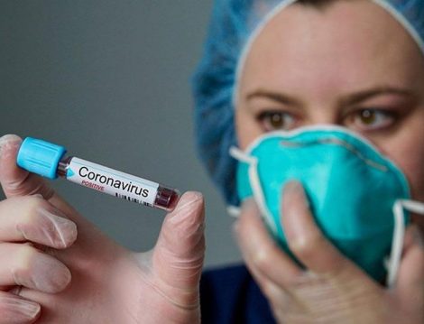 Coronavirüs Testi ve Tedavi Yöntemleri 