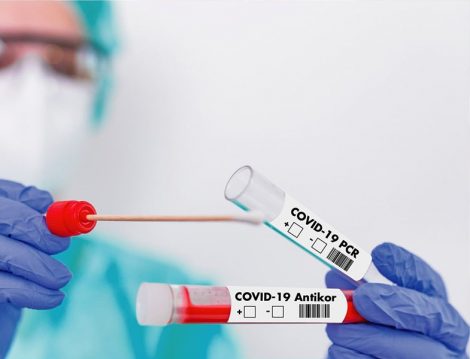 Covid-19 Testleri