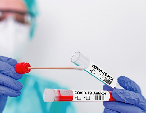 Covid-19’da Hangi Test Ne Kadar Güvenilir Sonuç Veriyor?